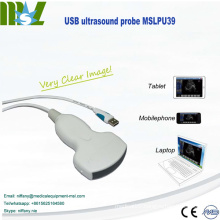 New arrival usb ultrasound probe for laptop in clinics, emergency and outdoor